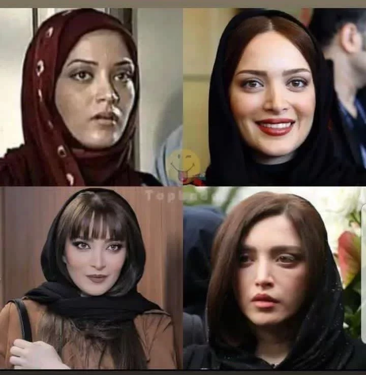 تغییرات چهره بهنوش طباطبایی در سالیان اخیر تغییرات چهره بهنوش طباطبایی در سالیان اخیر