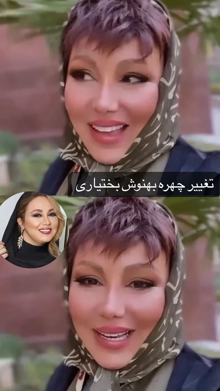 عکس | تغییر چهره و لاغری عجیب بهنوش بختیاری عکس | تغییر چهره و لاغری عجیب بهنوش بختیاری